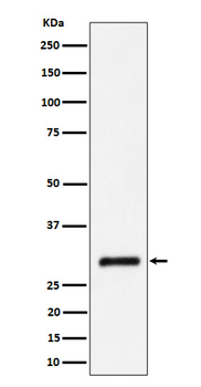 CBR1 Recombinant Rabbit Monoclonal Antibody