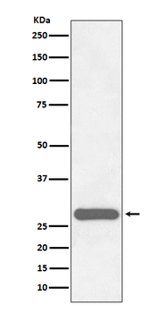 CITED2 Recombinant Rabbit Monoclonal Antibody