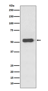 Estrogen receptor beta Recombinant Rabbit Monoclonal Antibody