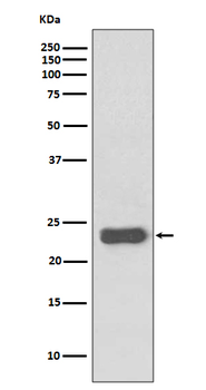 MGMT Recombinant Rabbit Monoclonal Antibody