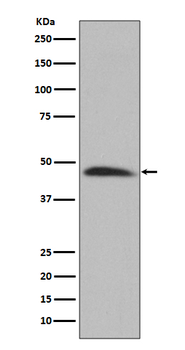 HSP47 Recombinant Rabbit Monoclonal Antibody
