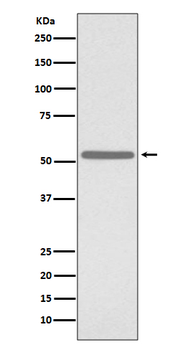 CDC25C Recombinant Rabbit Monoclonal Antibody