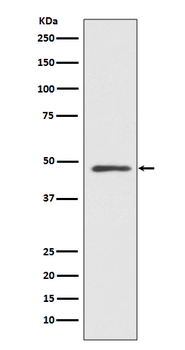MEK7 Recombinant Rabbit Monoclonal Antibody