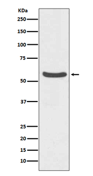 GLUT2 Recombinant Rabbit Monoclonal Antibody