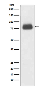 CD36 Recombinant Rabbit Monoclonal Antibody