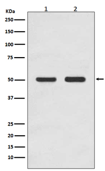 AP2M1 Recombinant Rabbit Monoclonal Antibody