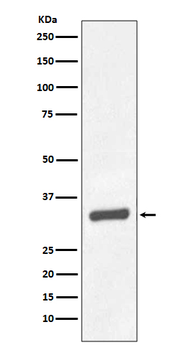 PSA Recombinant Rabbit Monoclonal Antibody