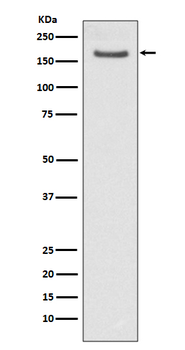 FANCD2 Recombinant Rabbit Monoclonal Antibody