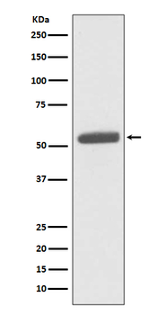 PKM2 Recombinant Rabbit Monoclonal Antibody