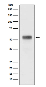 Retinoic acid receptor alpha Recombinant Rabbit Monoclonal Antibody