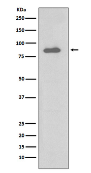 IKK alpha Recombinant Rabbit Monoclonal Antibody