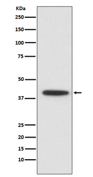 CEBP alpha Recombinant Rabbit Monoclonal Antibody
