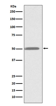 ILK Recombinant Rabbit Monoclonal Antibody