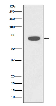 RAD18 Recombinant Rabbit Monoclonal Antibody