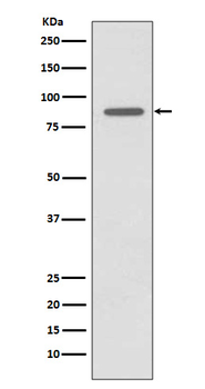 CD168 Recombinant Rabbit Monoclonal Antibody