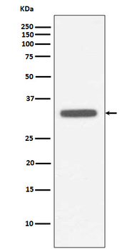 MyD88 Recombinant Rabbit Monoclonal Antibody