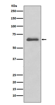 IRAKM Recombinant Rabbit Monoclonal Antibody