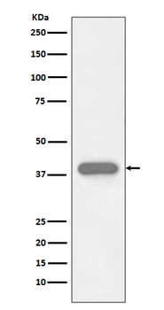 Cardiac Troponin T Recombinant Rabbit Monoclonal Antibody