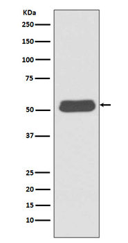 LSP1 Recombinant Rabbit Monoclonal Antibody