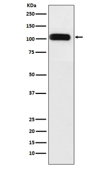 SERCA1 Recombinant Rabbit Monoclonal Antibody