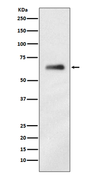 HnRNP K Recombinant Rabbit Monoclonal Antibody