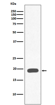 Myoglobin Recombinant Rabbit Monoclonal Antibody