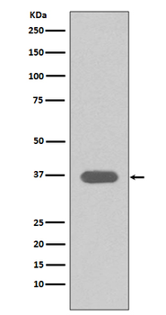 MSI2 Recombinant Rabbit Monoclonal Antibody