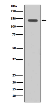 FGFR1 Recombinant Rabbit Monoclonal Antibody