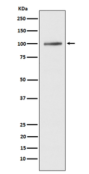 SERCA1 Recombinant Rabbit Monoclonal Antibody