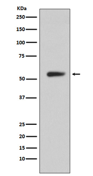 CA9 Recombinant Rabbit Monoclonal Antibody