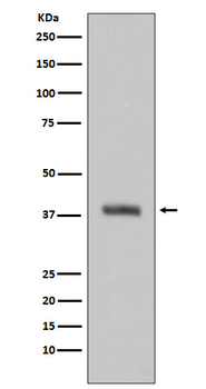 HTRA2 Recombinant Rabbit Monoclonal Antibody