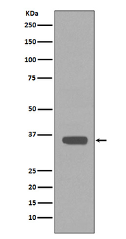Apolipoprotein E Recombinant Rabbit Monoclonal Antibody