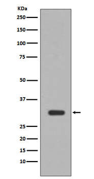 PIM1 Recombinant Rabbit Monoclonal Antibody