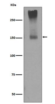 MGluR5 Recombinant Rabbit Monoclonal Antibody