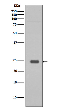 RAB9 Recombinant Rabbit Monoclonal Antibody