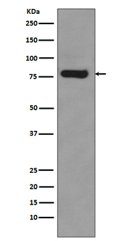 Androgen receptor Recombinant Rabbit Monoclonal Antibody