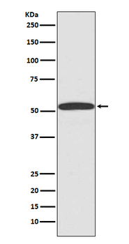 Beta Arrestin 1 Recombinant Rabbit Monoclonal Antibody
