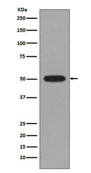 Beta 4B/2A/2B Tubulin Recombinant Rabbit Monoclonal Antibody