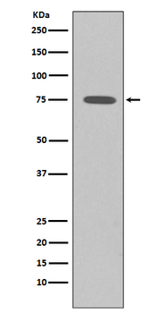 Somatostatin Receptor 2 Recombinant Rabbit Monoclonal Antibody