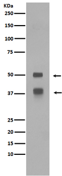 LEF1 Recombinant Rabbit Monoclonal Antibody
