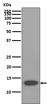 Beta 2 Microglobulin Recombinant Rabbit Monoclonal Antibody