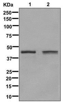 Glutamine synthetase Recombinant Rabbit Monoclonal Antibody