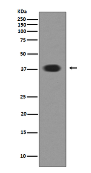 Musashi 1 Recombinant Rabbit Monoclonal Antibody