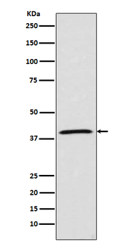 MCL1 Recombinant Rabbit Monoclonal Antibody