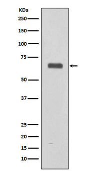 Complement C9 Recombinant Rabbit Monoclonal Antibody