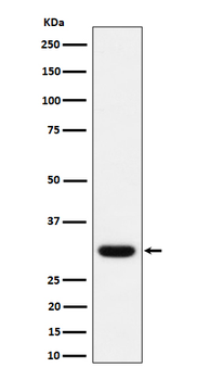 Adiponectin Recombinant Rabbit Monoclonal Antibody
