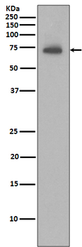 API2/BIRC3 Recombinant Rabbit Monoclonal Antibody