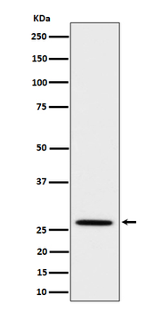Adiponectin Recombinant Rabbit Monoclonal Antibody