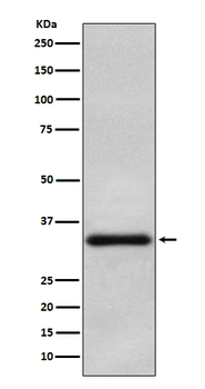 OLIG2 Recombinant Rabbit Monoclonal Antibody