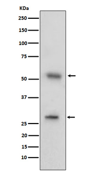CD97 Recombinant Rabbit Monoclonal Antibody